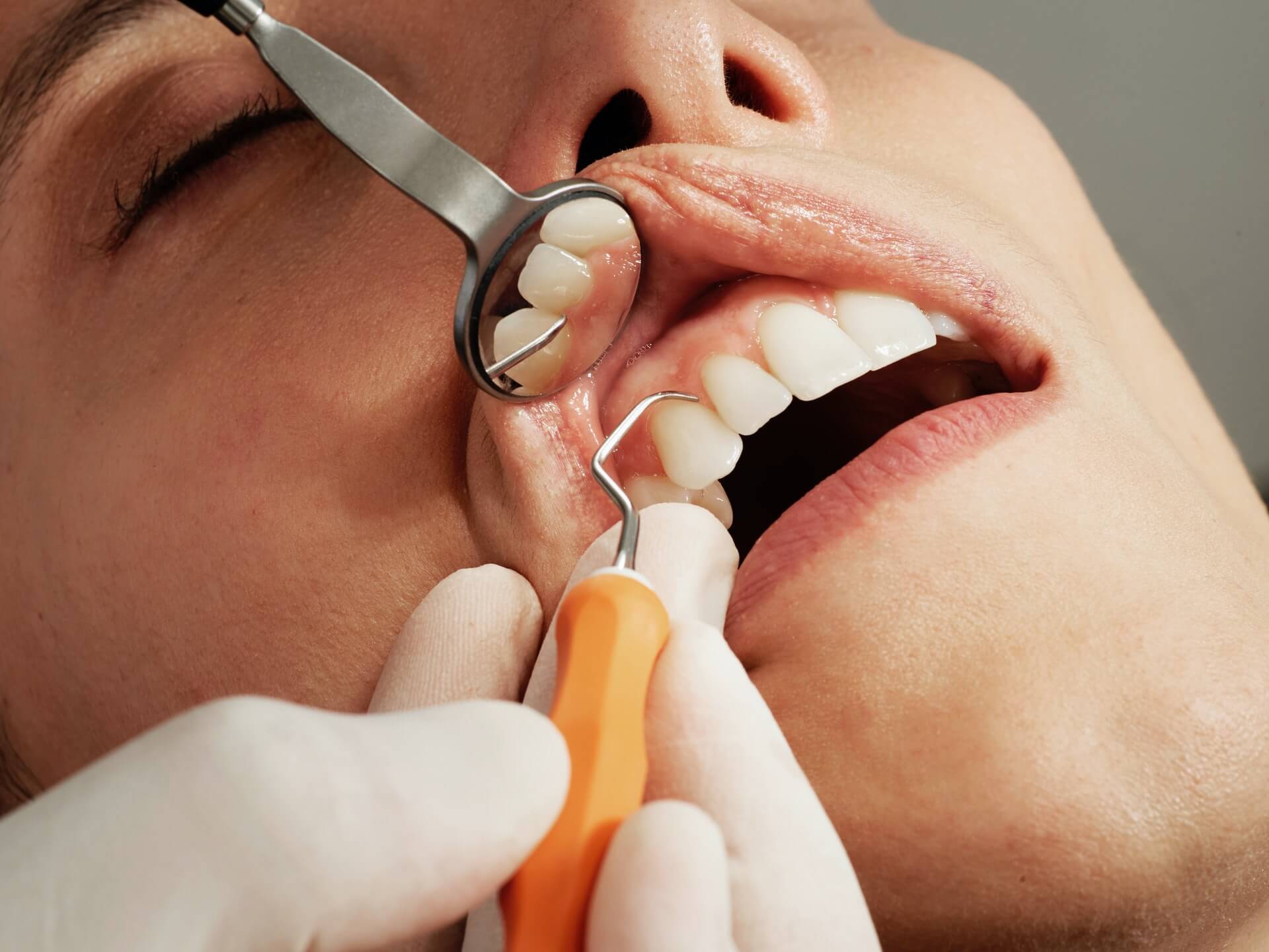 Tandenkliniek Amsterdam Zeecare Dental